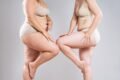 lipodem ile kilo sebebimi Veremediğiniz İnatçı Kiloların Sebebi Lipödem Olabilir